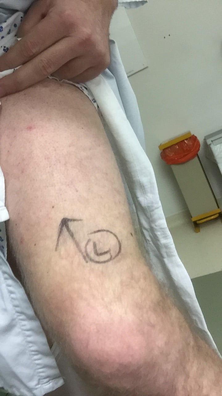 Testicular cancer
